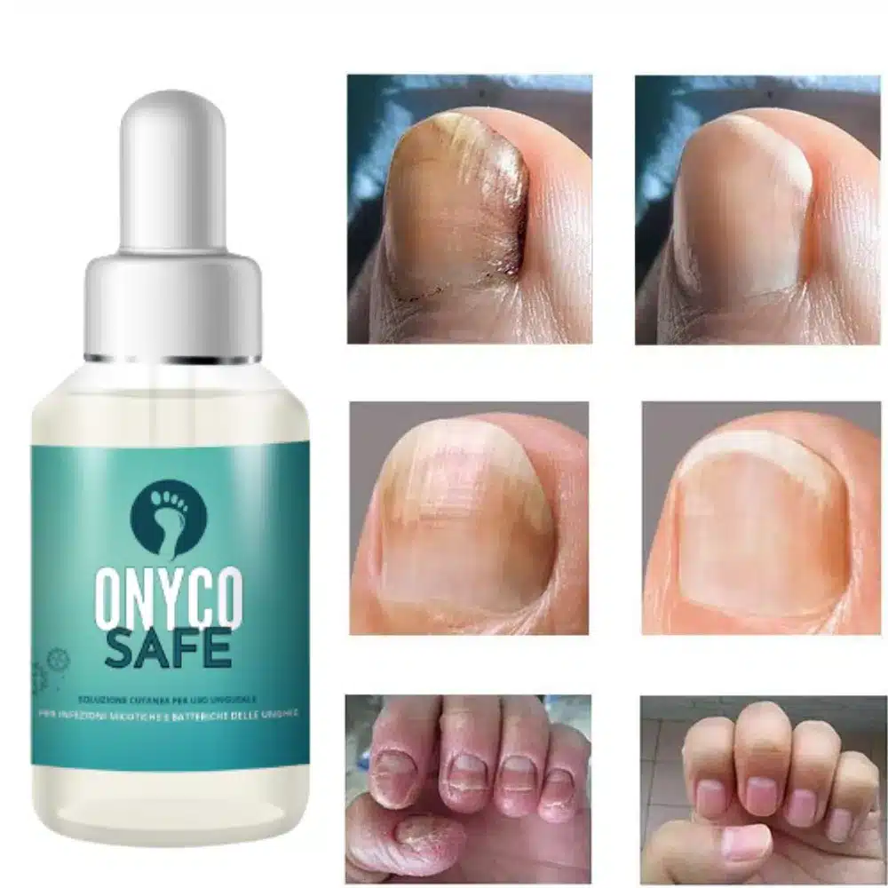 onyco safe antimicotico