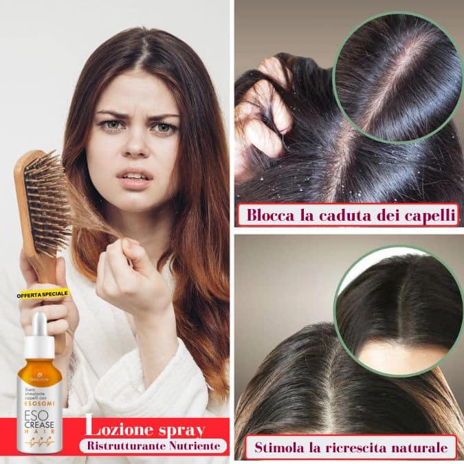 chioma pro contro la caduta dei capelli - versione esocrease hair